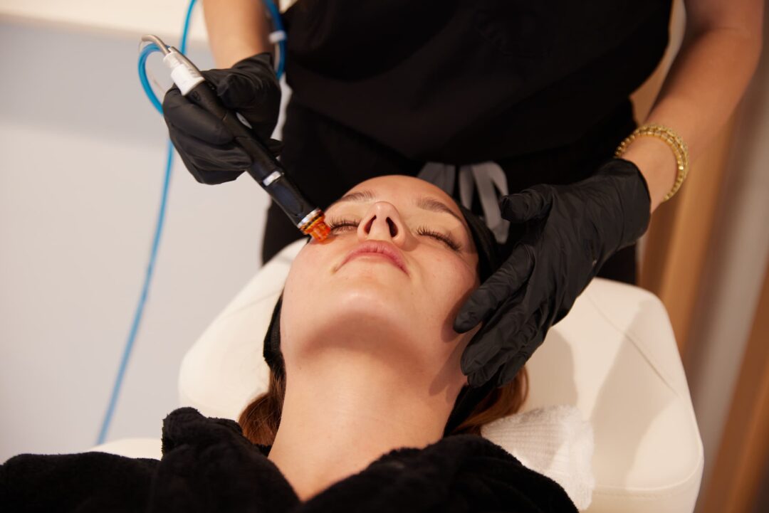 HydraFacial treatment being performed by a professional at Infinite Medical Spa in London, Ontario. Deeply cleanse, exfoliate, and hydrate your skin with the #1 non-invasive facial loved for its immediate, glowing results.