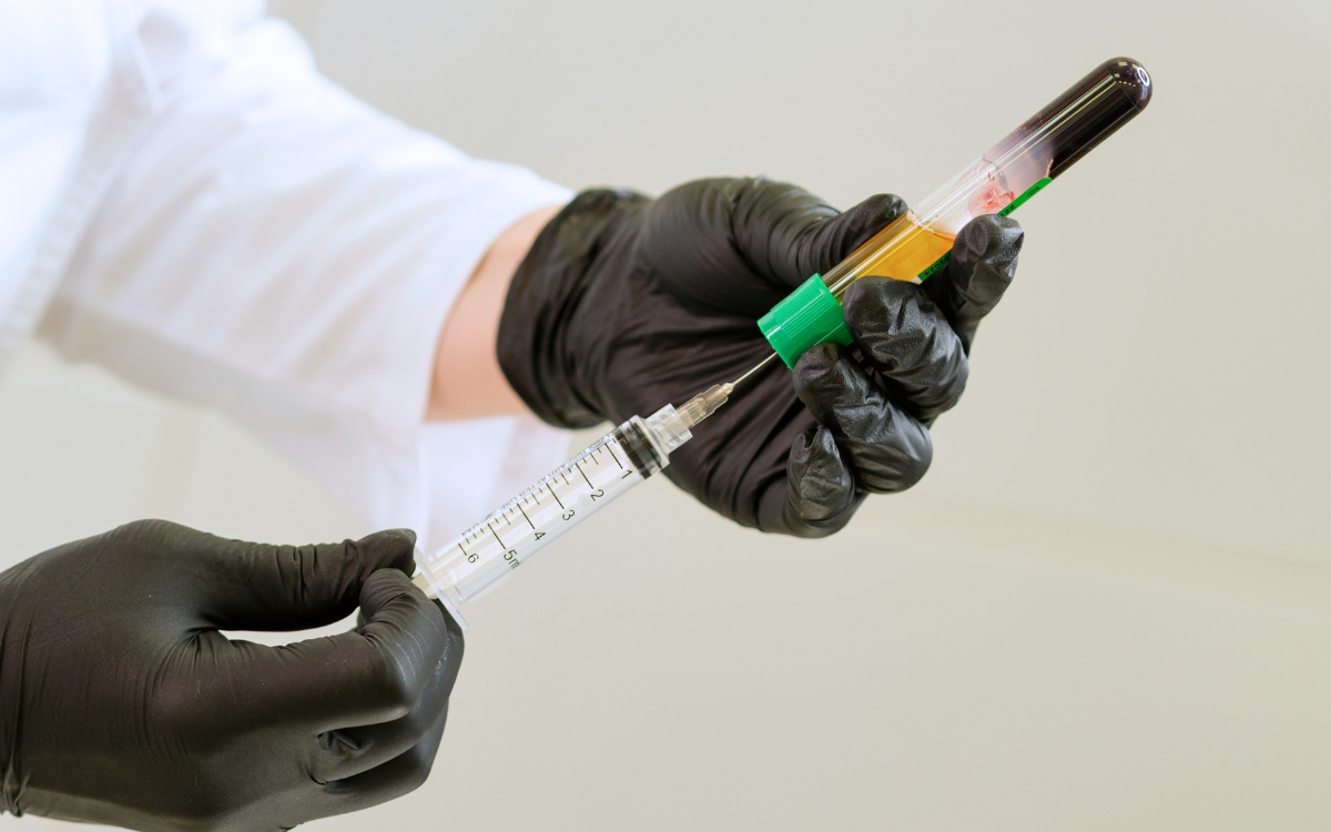 Close up of blood draw from vile for PRP and PRF Injections at Infinite Medical Spa