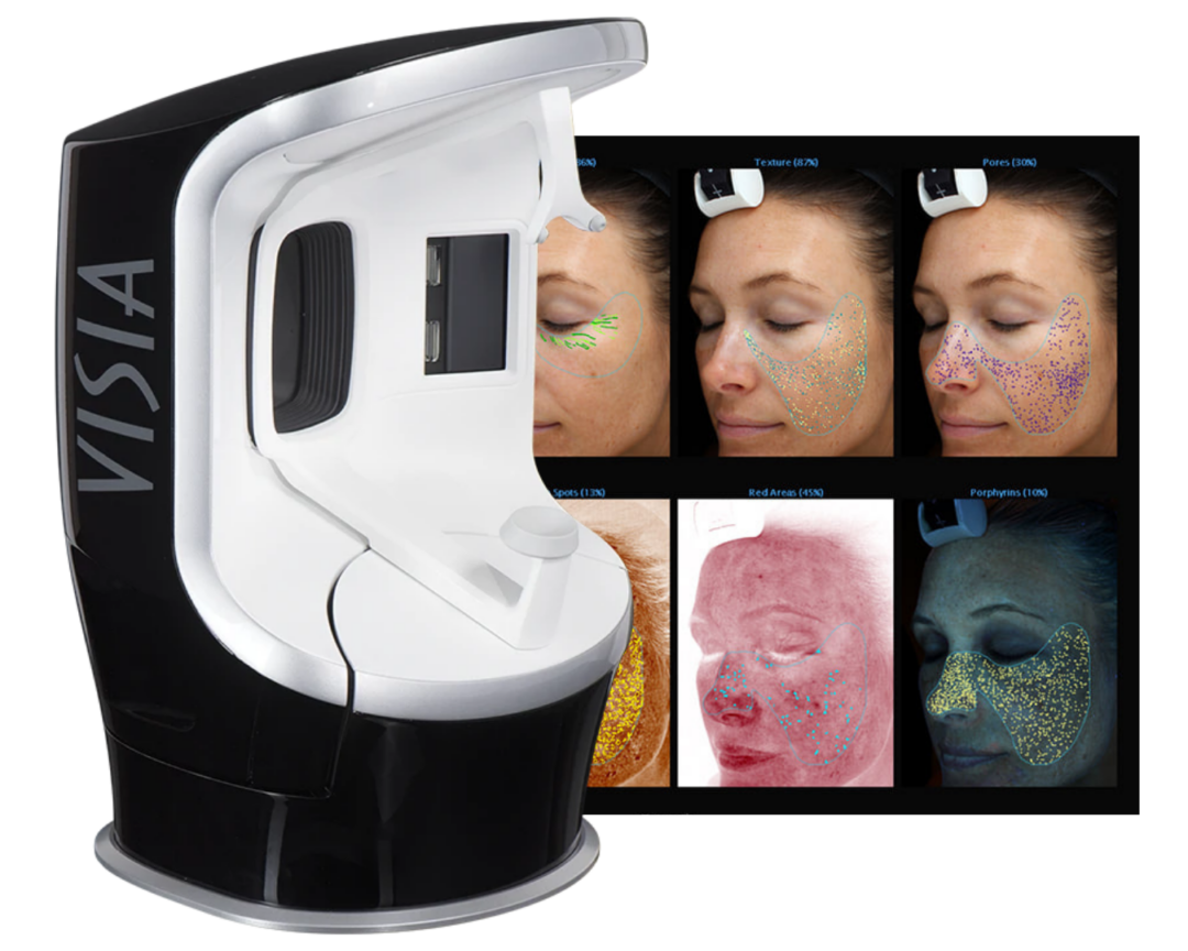 The Visia Skin Analysis machine and the computer screen showing the patients scan results at Infinite Medical Spa in London, Ontario