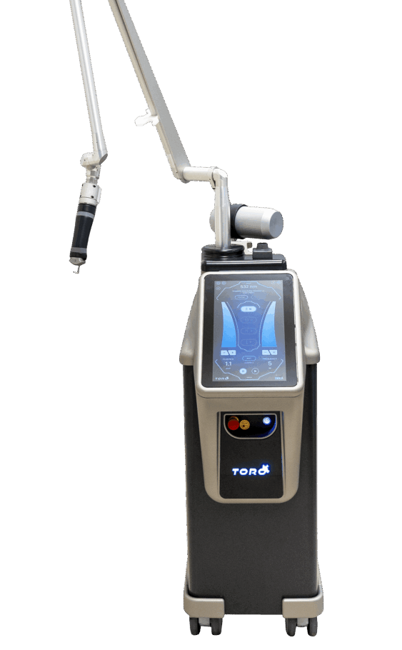DEKA Toro Laser for tattoo removal, pigment reduction, and skin toning at Infinite Medical Spa in London, Ontario