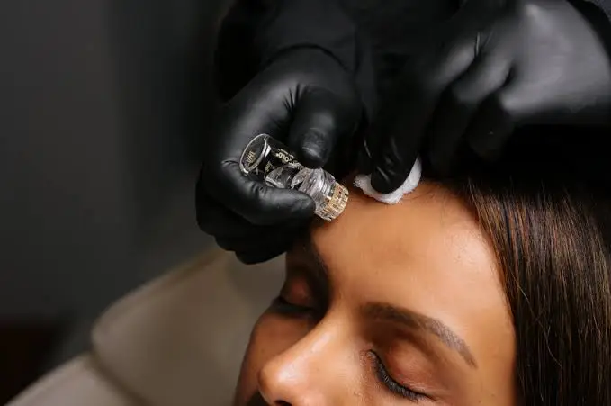 Client receiving an Aquagold microchanneling facial treatment at Infinite Medical Spa in London, Ontario