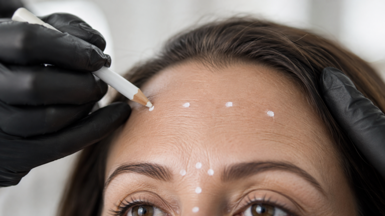 Nurse injector performing forehead Botox on a patient at Infinite Medical Spa in London, Ontario